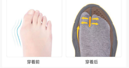 Best Shoes for Women with Bunions: Style Meets Comfort