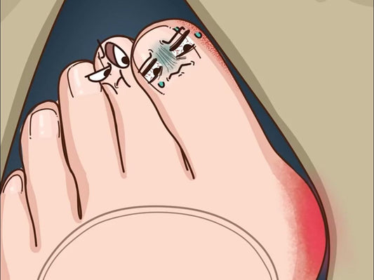 Best Bunion shoes-Friendly Footwear: A Guide to Happy Feet