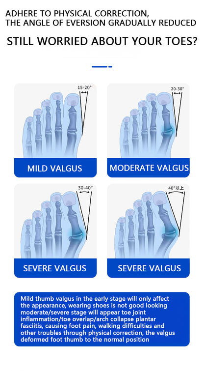 foot pain relief for bunions
